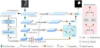 DFA-UNet: dual-stream feature-fusion attention U-Net for lymph node segmentation in lung cancer diagnosis